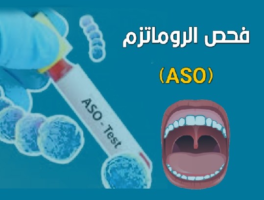 فحص aso