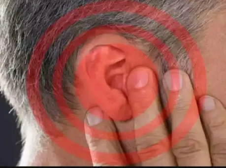 طنين الأذن