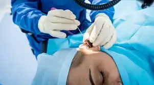 ترقيع غشاء الطبلة